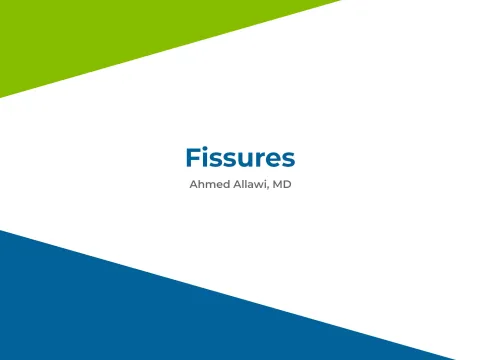 Fissures by Ahmed Allawi